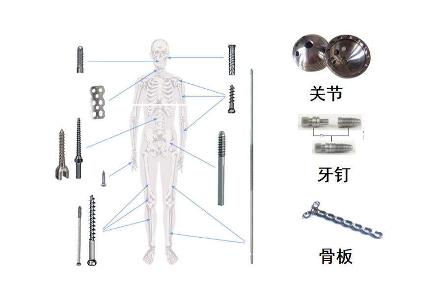 醫(yī)療骨科、牙釘、脊椎